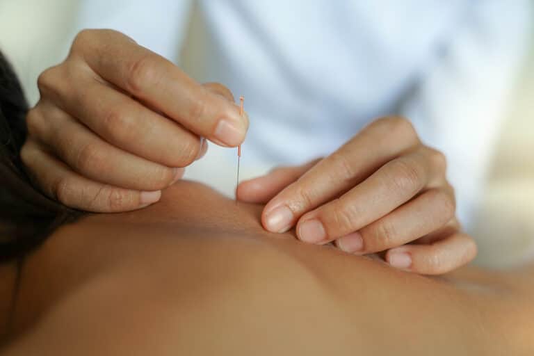 Dry needling massage at Genesis Spa MD